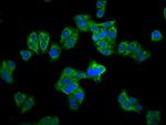 CPS1 Polyclonal Antibody