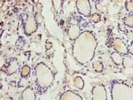 CRABP1 Polyclonal Antibody
