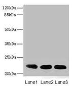 CRIP2 Antibody in Western Blot (WB)