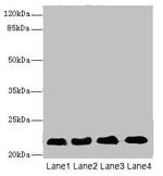 CRIP2 Antibody in Western Blot (WB)