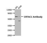 CRTAC1 Polyclonal Antibody