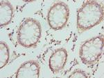 CRTAP Antibody in Immunohistochemistry (Paraffin) (IHC (P))