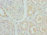 CRTAP Polyclonal Antibody