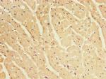 CRYBA1 Antibody in Immunohistochemistry (Paraffin) (IHC (P))