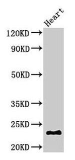 CRYBA4 Antibody in Western Blot (WB)