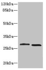 CRYBB1 Polyclonal Antibody