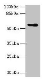 CSAD Polyclonal Antibody