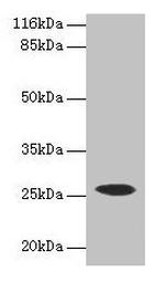 CSHL1 Antibody in Western Blot (WB)