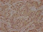 CSK Polyclonal Antibody