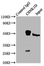 CK1 delta Antibody in Western Blot (WB)