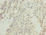 CK1 gamma-2 Antibody in Immunohistochemistry (Paraffin) (IHC (P))