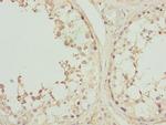 CK1 gamma-2 Polyclonal Antibody