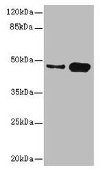 CK1 gamma-2 Antibody in Western Blot (WB)