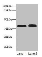 Cathepsin L Polyclonal Antibody