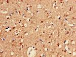 CUG-BP2 Antibody in Immunohistochemistry (Paraffin) (IHC (P))