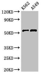 CUG-BP2 Antibody in Western Blot (WB)
