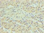 CYP11A1 Polyclonal Antibody