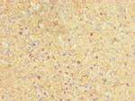 CYP17A1 Antibody in Immunohistochemistry (Paraffin) (IHC (P))