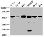 CYP21A2 Antibody in Western Blot (WB)