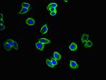 CYSLTR1 Antibody in Immunocytochemistry (ICC/IF)