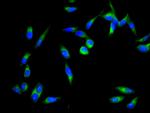 ZIPK Polyclonal Antibody