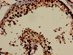 DNAL4 Antibody in Immunohistochemistry (Paraffin) (IHC (P))