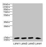 DNAL4 Antibody in Western Blot (WB)
