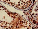 DNALI1 Antibody in Immunohistochemistry (Paraffin) (IHC (P))