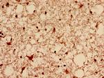DNM1L Antibody in Immunohistochemistry (Paraffin) (IHC (P))