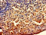 DOK5 Antibody in Immunohistochemistry (Paraffin) (IHC (P))