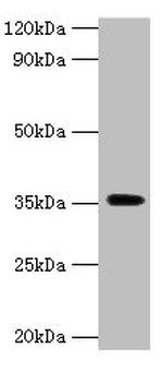 DOK5 Antibody in Western Blot (WB)