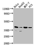 DUSP11 Polyclonal Antibody