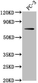 DVL1P1 Polyclonal Antibody