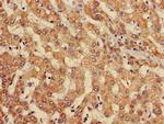 EBI3 Polyclonal Antibody