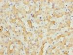 ECHS1 Polyclonal Antibody
