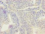 ECHS1 Antibody in Immunohistochemistry (Paraffin) (IHC (P))