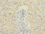 ECHS1 Polyclonal Antibody