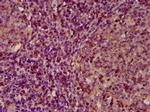 ECM1 Polyclonal Antibody