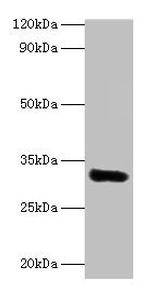 EEF1D Polyclonal Antibody