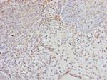 eIF2 gamma Polyclonal Antibody