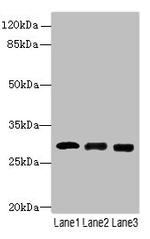 ELA3A Polyclonal Antibody