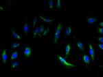 EMP3 Polyclonal Antibody