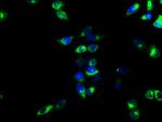 CD39 Antibody in Immunocytochemistry (ICC/IF)