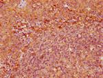 CD39 Antibody in Immunohistochemistry (Paraffin) (IHC (P))