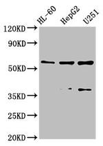 CD39 Antibody in Western Blot (WB)