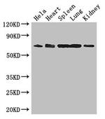 ENTPD7 Antibody in Western Blot (WB)