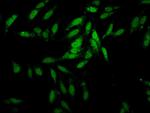 ESRP2 Polyclonal Antibody
