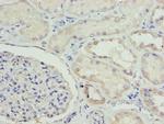 ETFA Polyclonal Antibody
