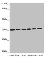 ETFA Antibody in Western Blot (WB)