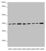 ETFA Antibody in Western Blot (WB)